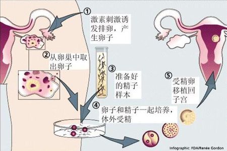 针灸